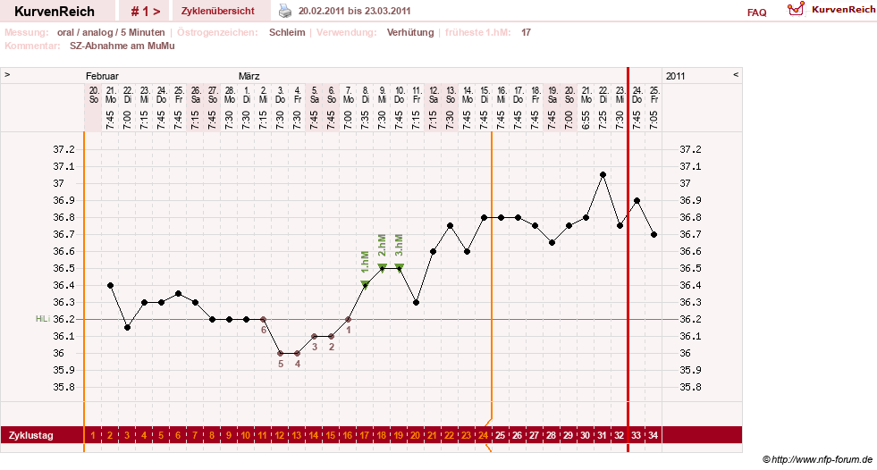 NFP-Kurve User #15285