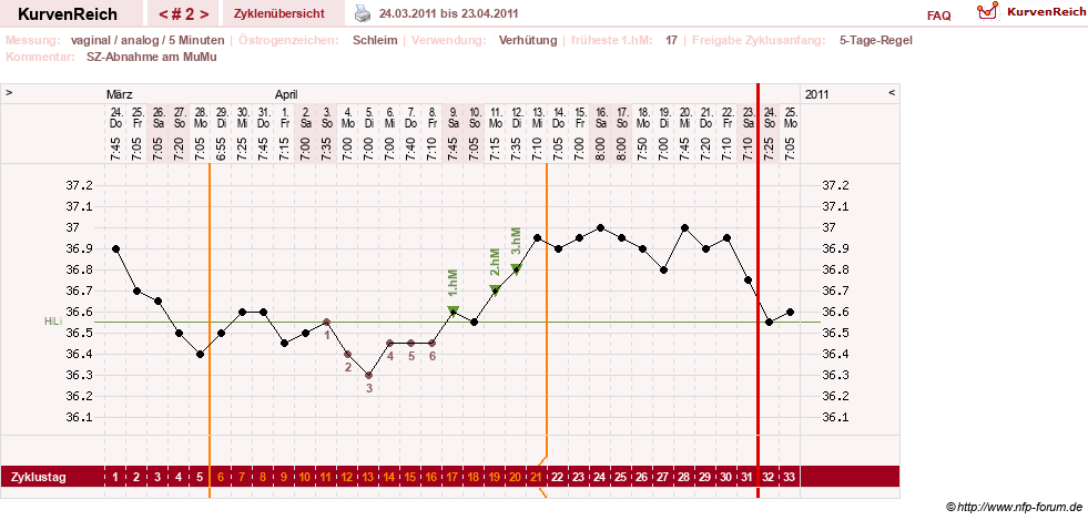 NFP-Kurve User #15285