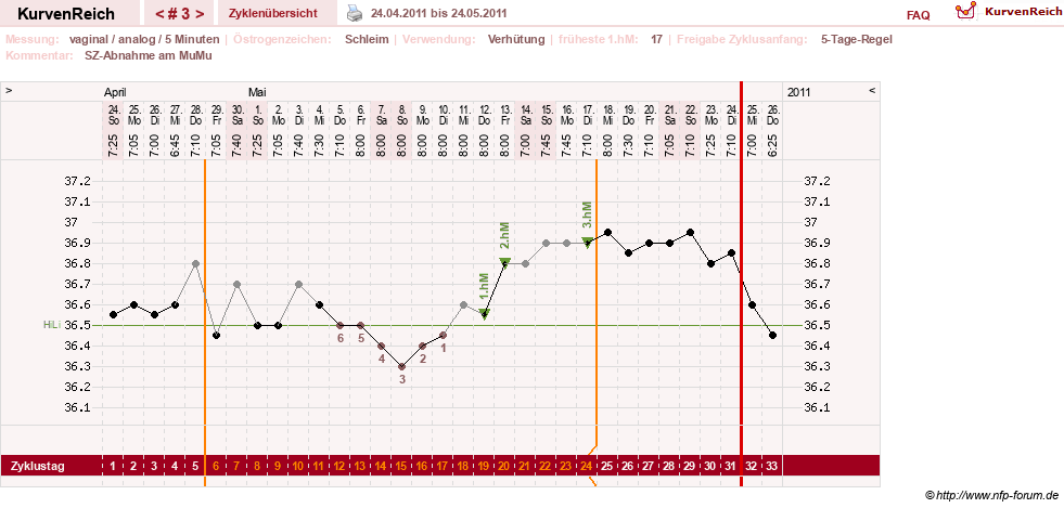NFP-Kurve User #15285