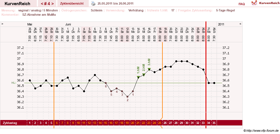 NFP-Kurve User #15285
