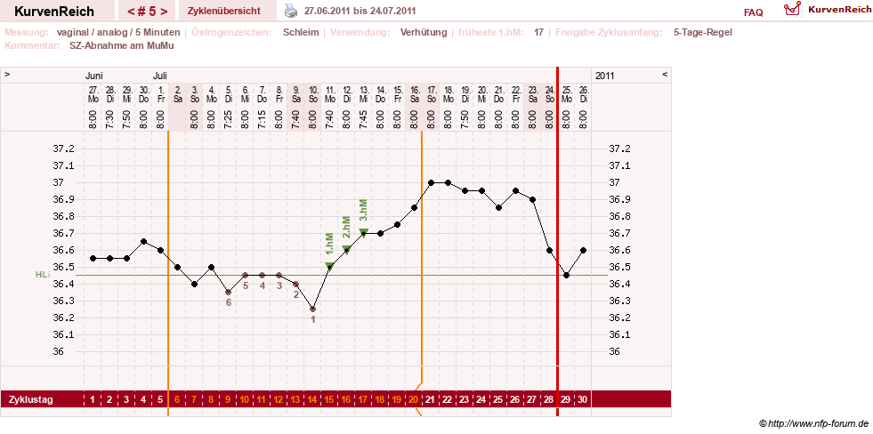 NFP-Kurve User #15285