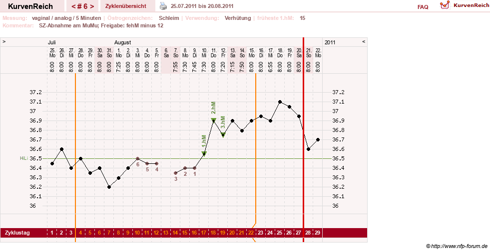 NFP-Kurve User #15285