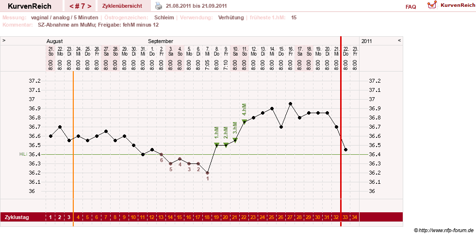 NFP-Kurve User #15285