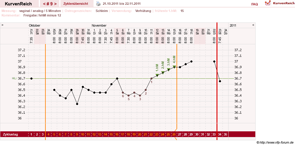 NFP-Kurve User #15285