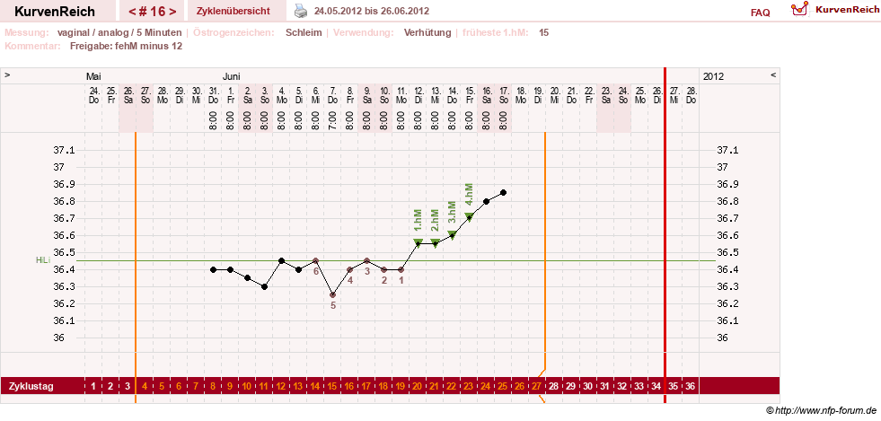 NFP-Kurve User #15285