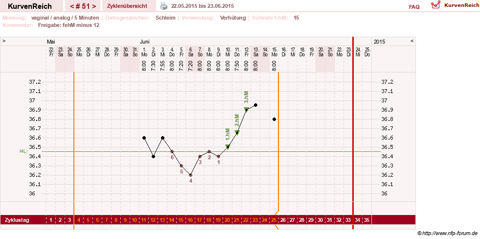 NFP-Kurve User #15285