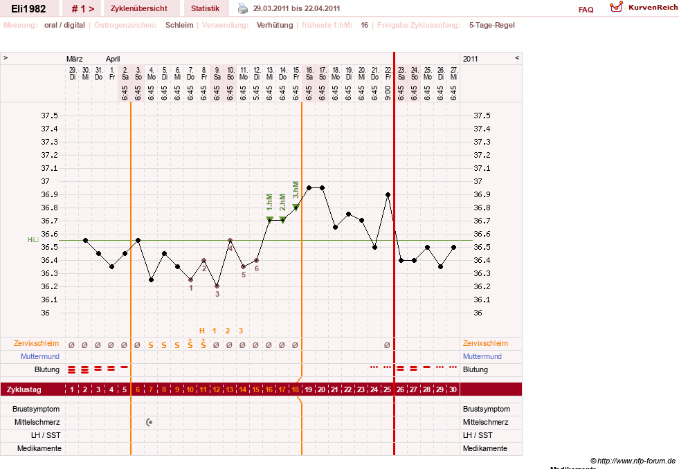 NFP-Kurve User #15396