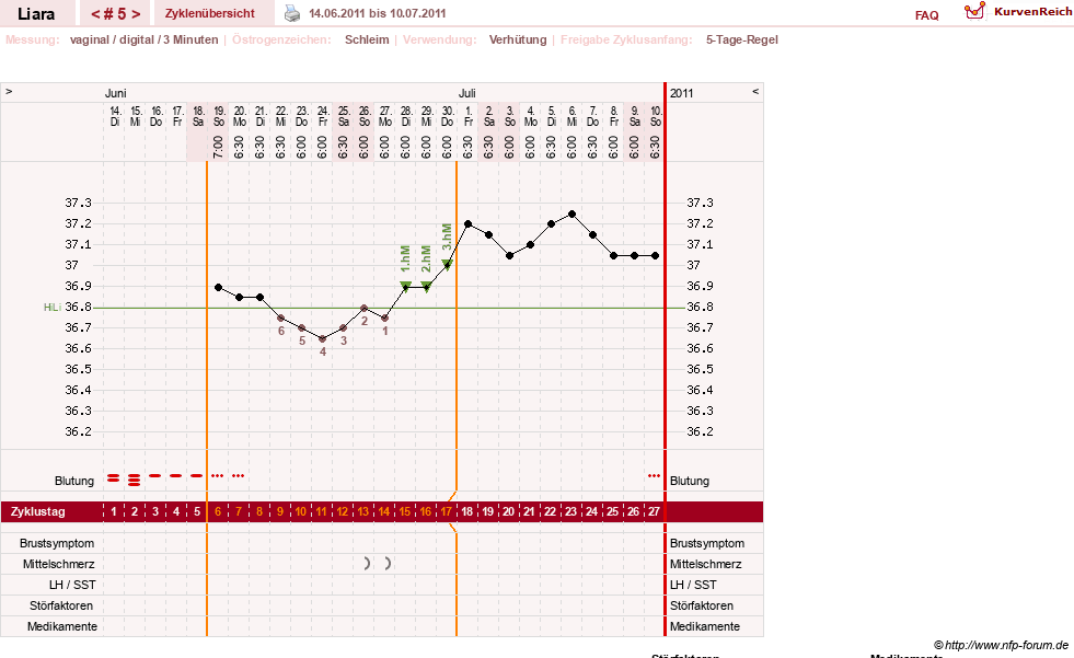 NFP-Kurve User #15490