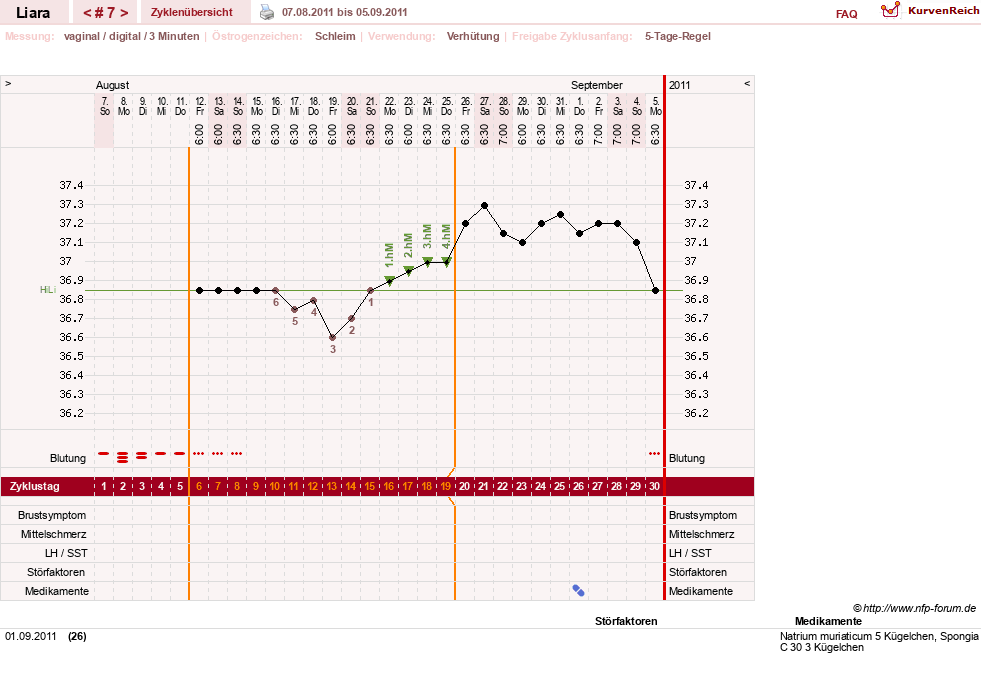 NFP-Kurve User #15490