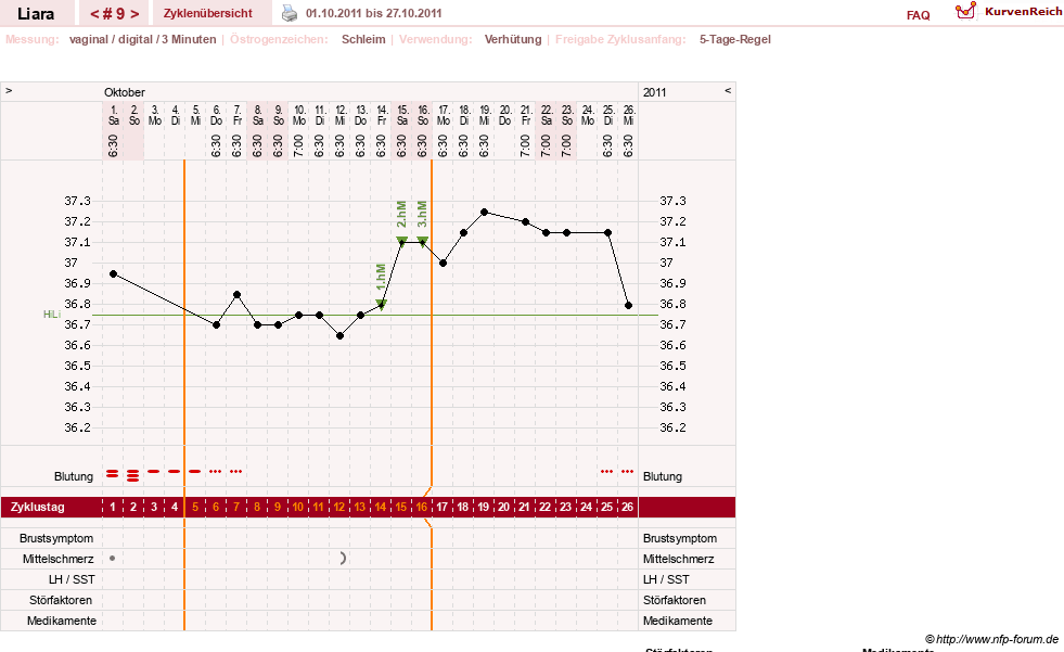 NFP-Kurve User #15490