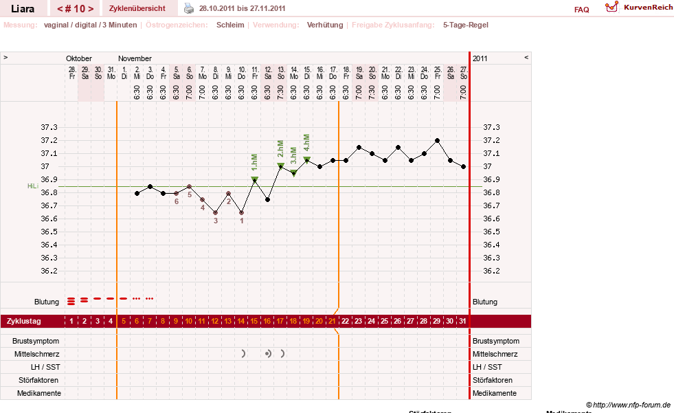 NFP-Kurve User #15490