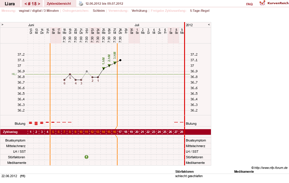 NFP-Kurve User #15490