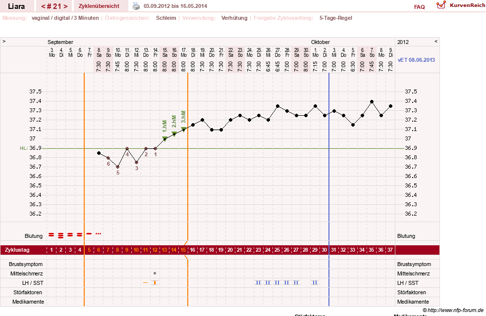 NFP-Kurve User #15490