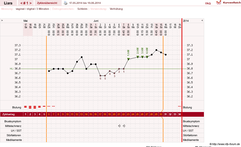 NFP-Kurve User #15490