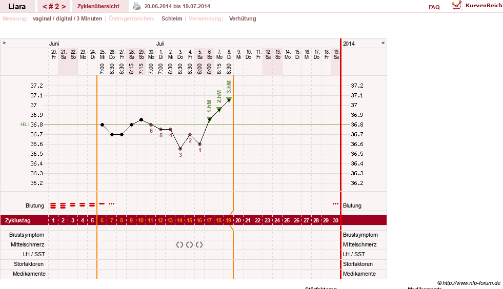 NFP-Kurve User #15490