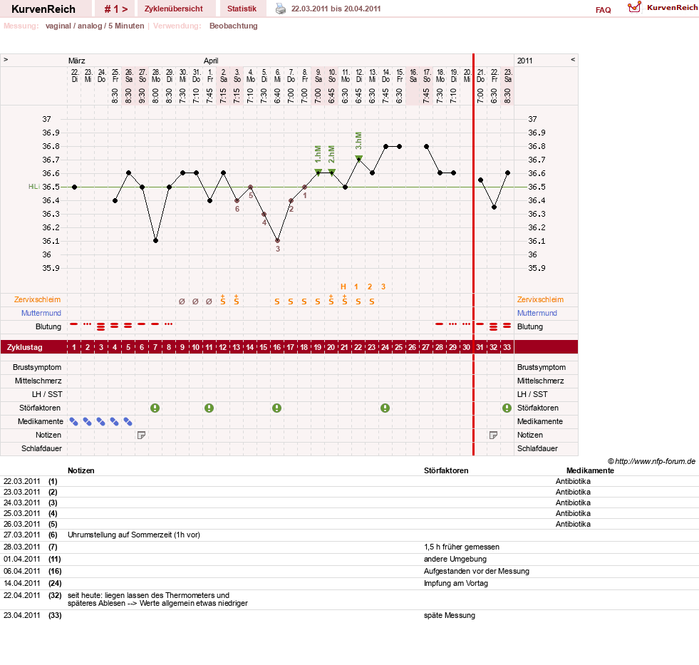 NFP-Kurve User #15552
