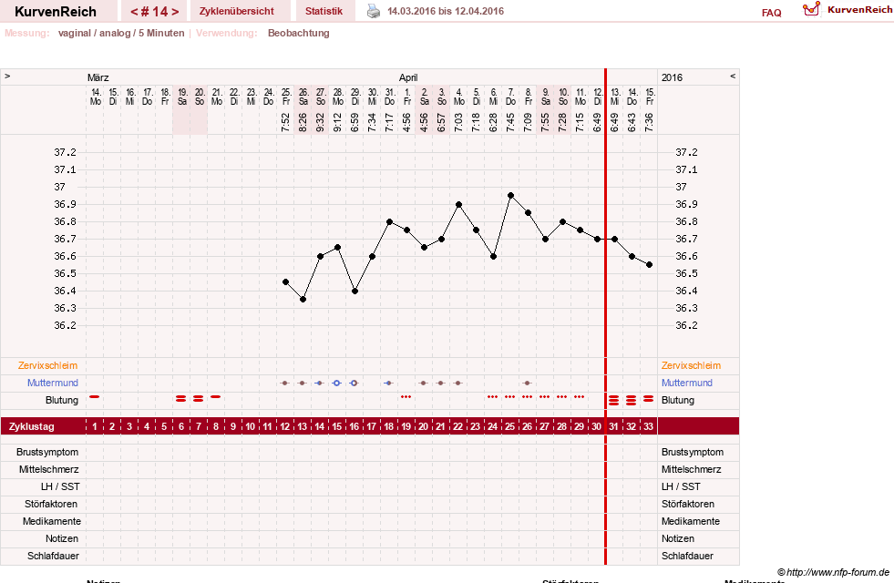 NFP-Kurve User #15552