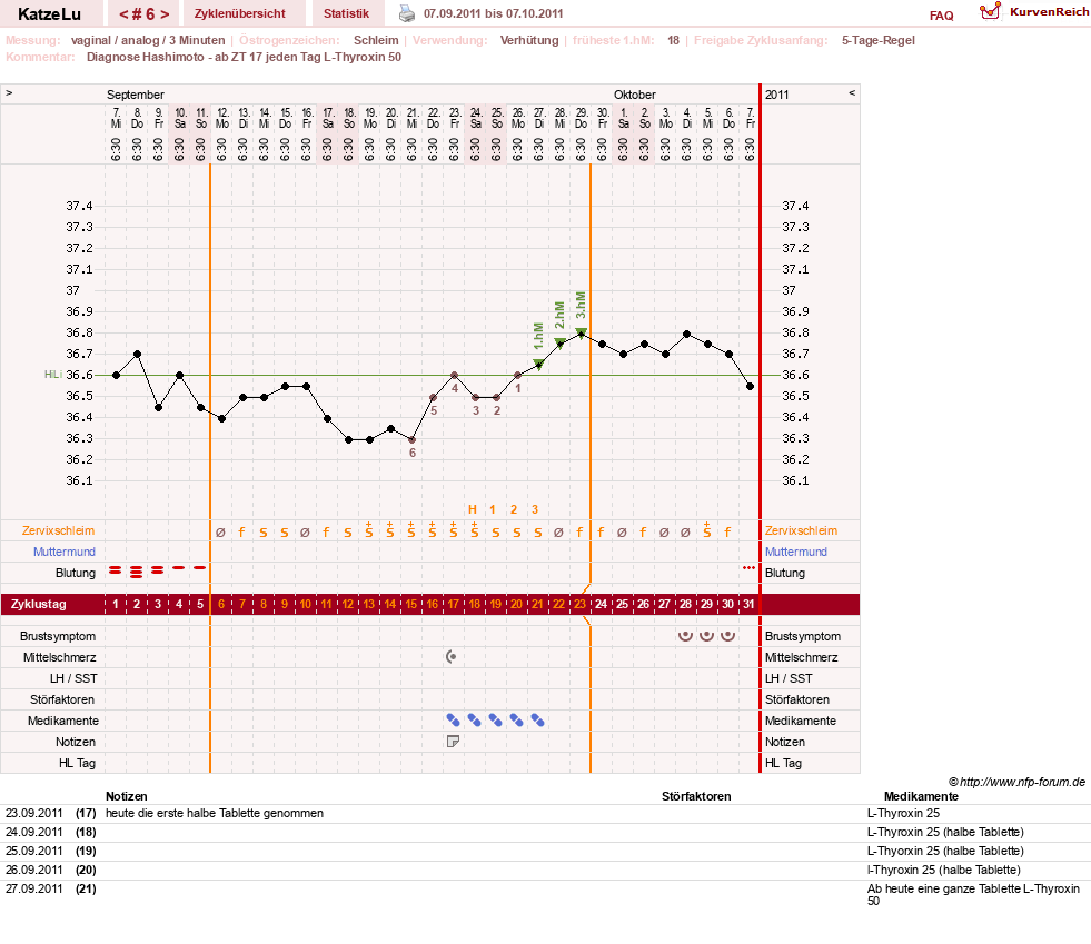 NFP-Kurve User #15638