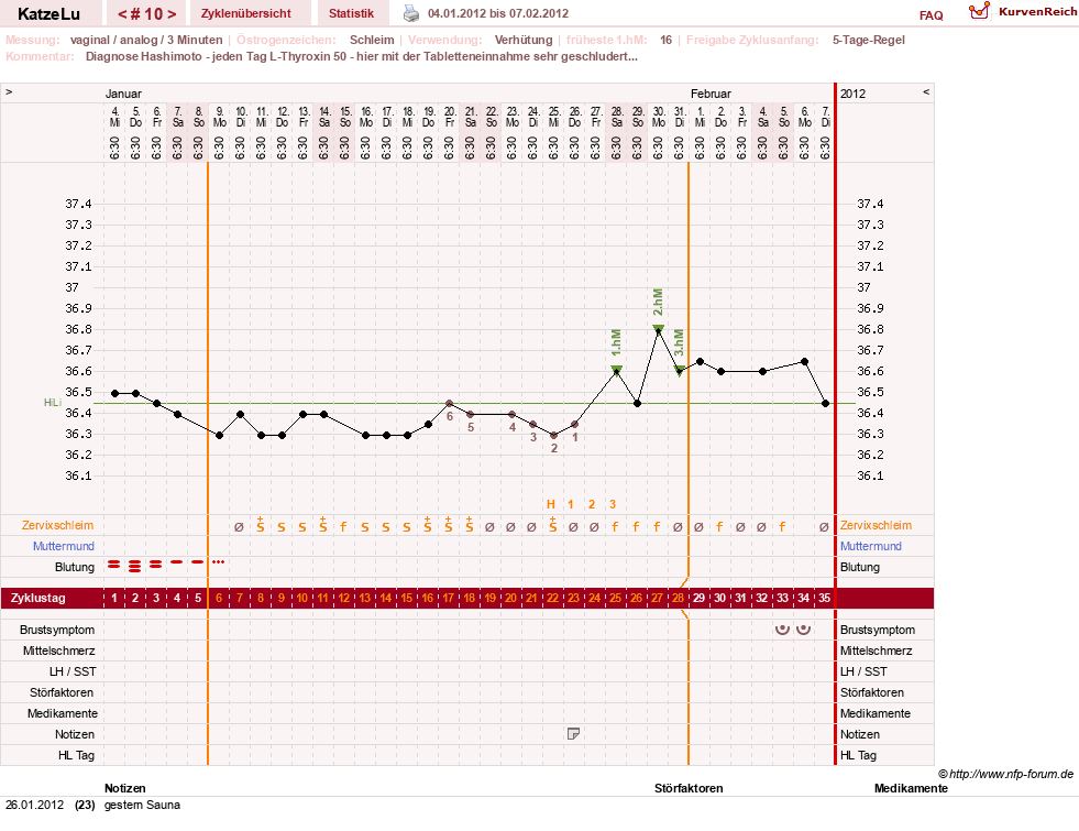 NFP-Kurve User #15638