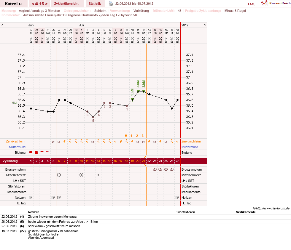 NFP-Kurve User #15638