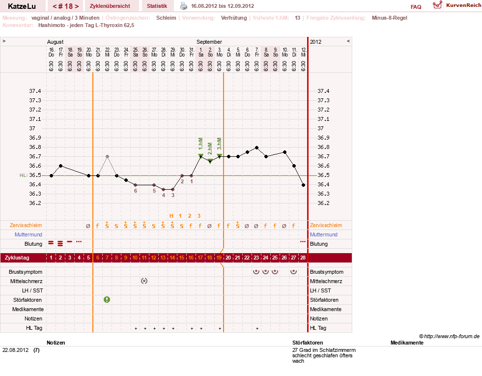 NFP-Kurve User #15638