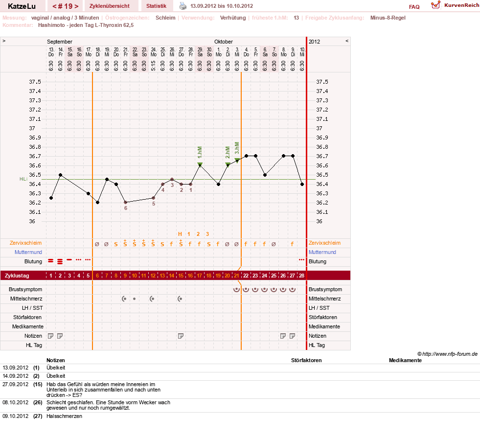 NFP-Kurve User #15638