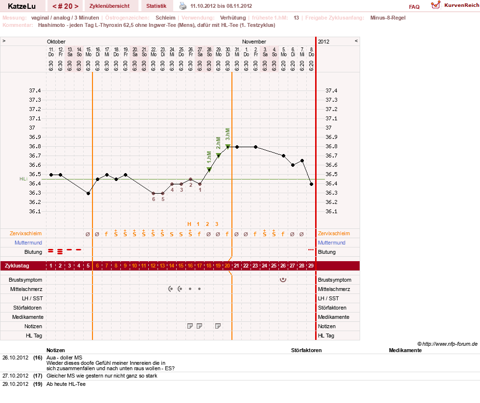 NFP-Kurve User #15638