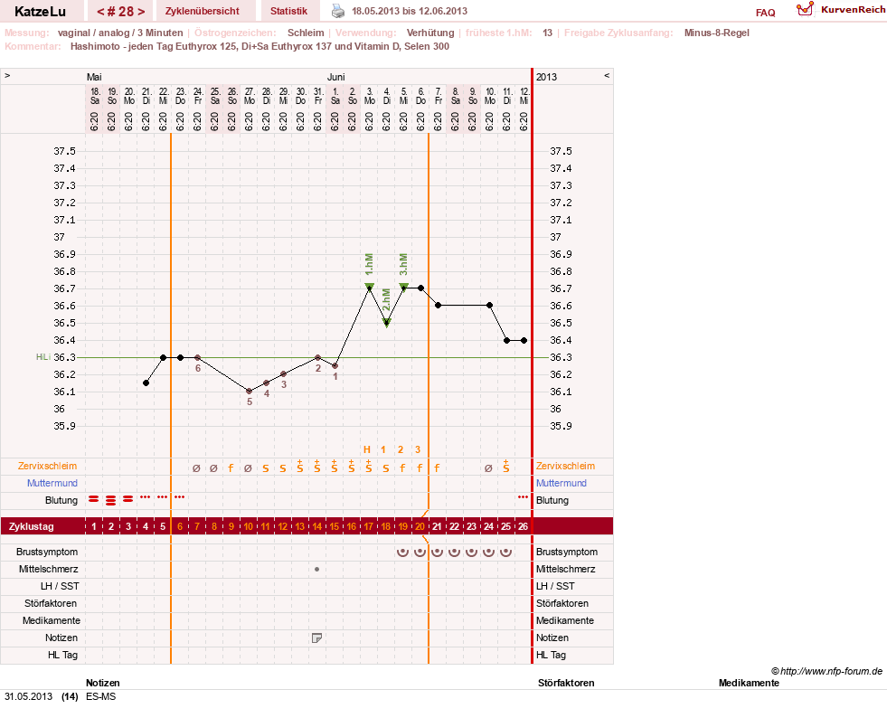 NFP-Kurve User #15638