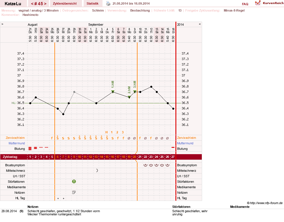 NFP-Kurve User #15638