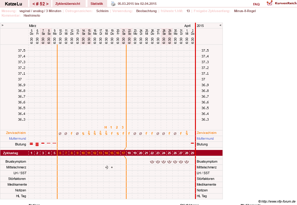 NFP-Kurve User #15638