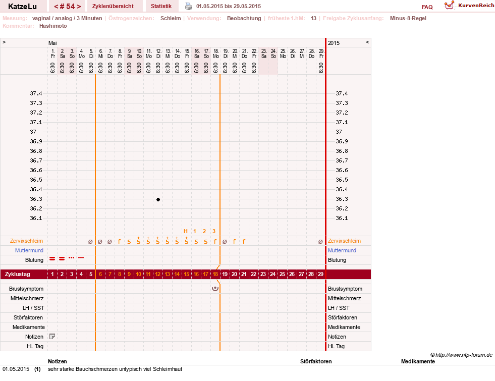 NFP-Kurve User #15638