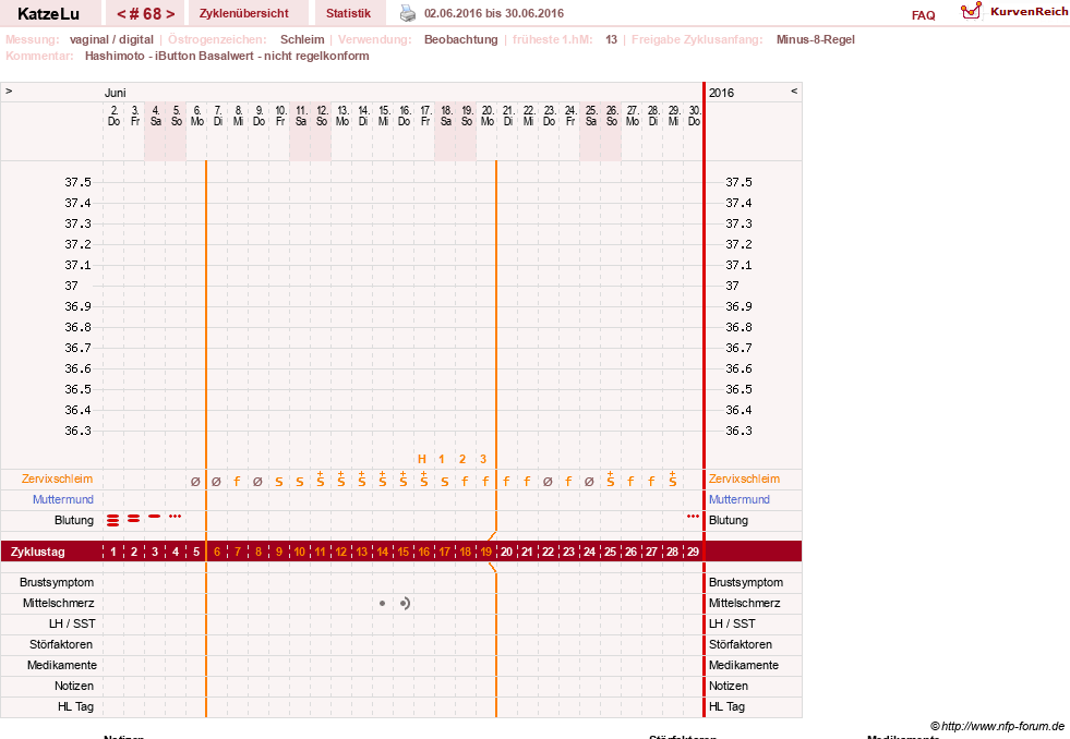 NFP-Kurve User #15638