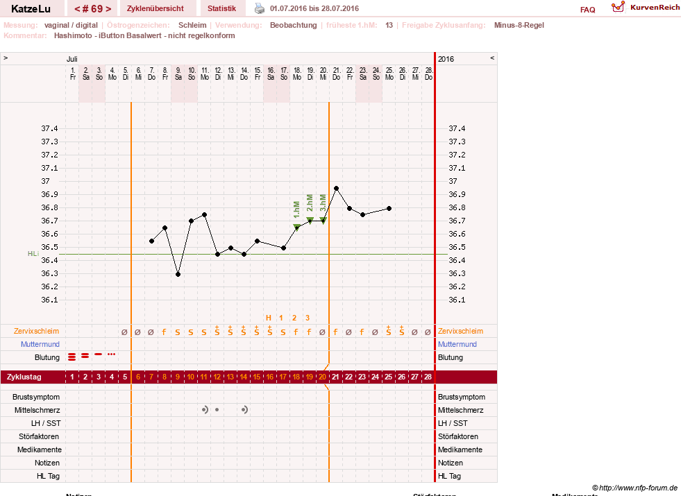 NFP-Kurve User #15638