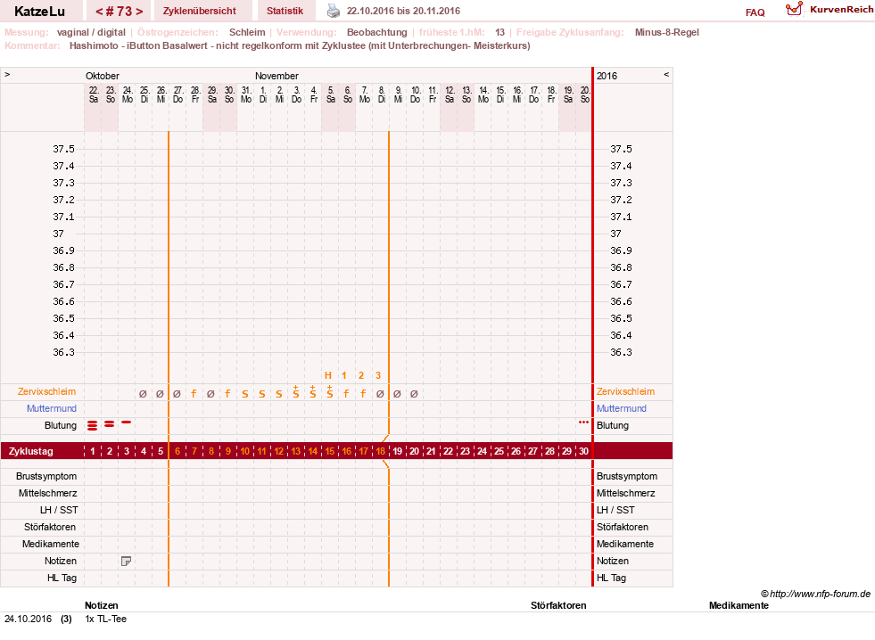 NFP-Kurve User #15638