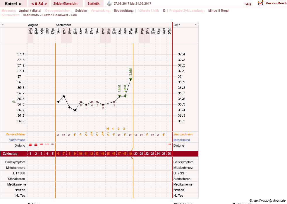 NFP-Kurve User #15638