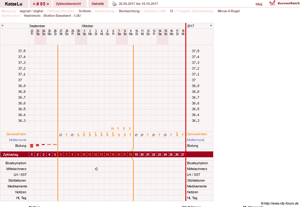 NFP-Kurve User #15638