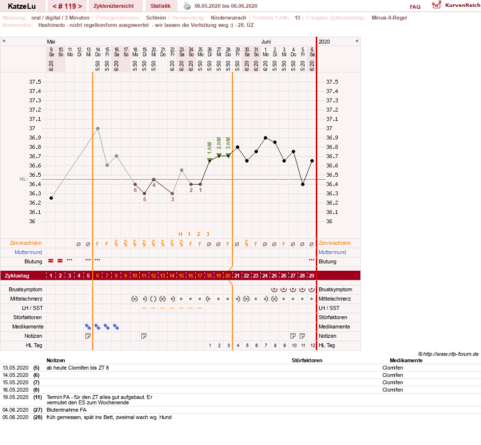 NFP-Kurve User #15638