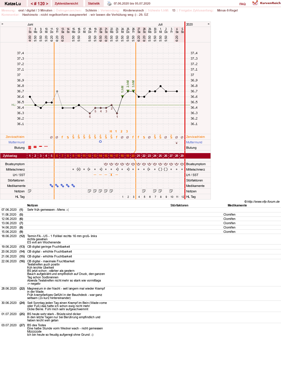 NFP-Kurve User #15638
