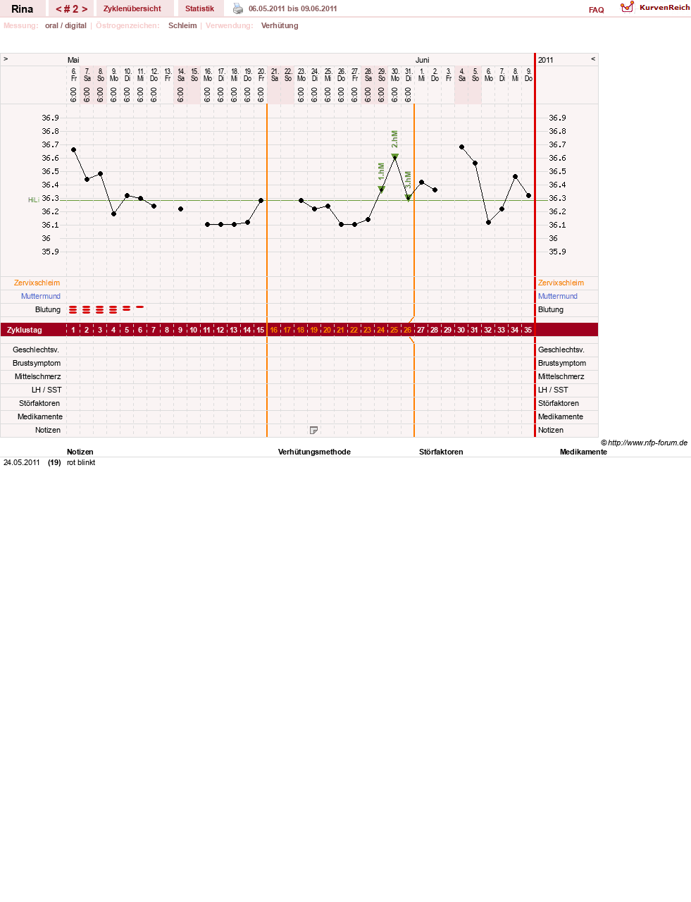 NFP-Kurve User #15656