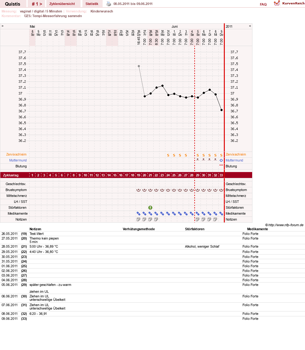 NFP-Kurve User #15671