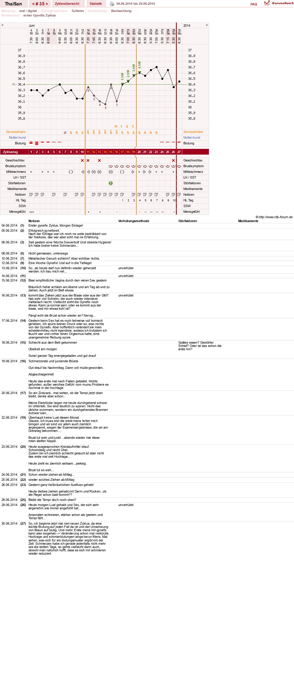 NFP-Kurve User #15832