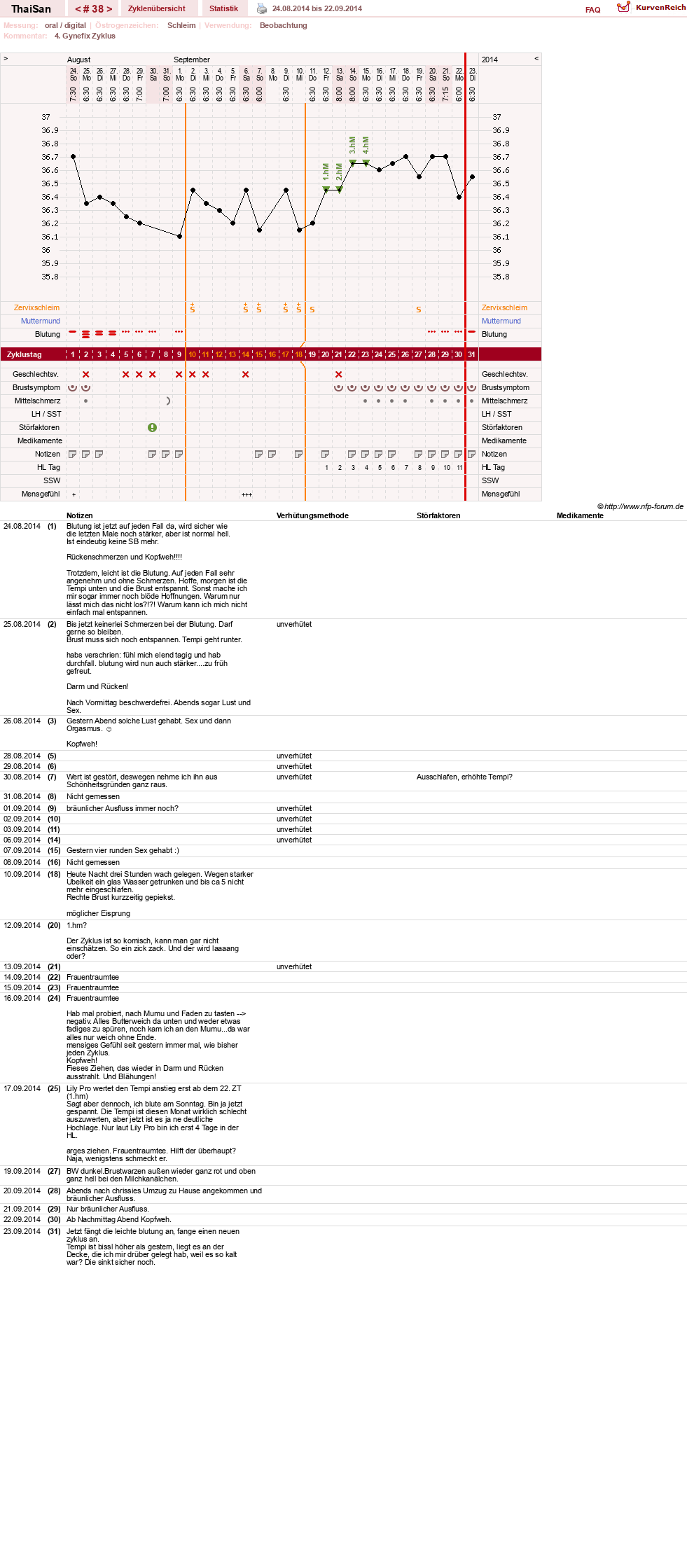 NFP-Kurve User #15832