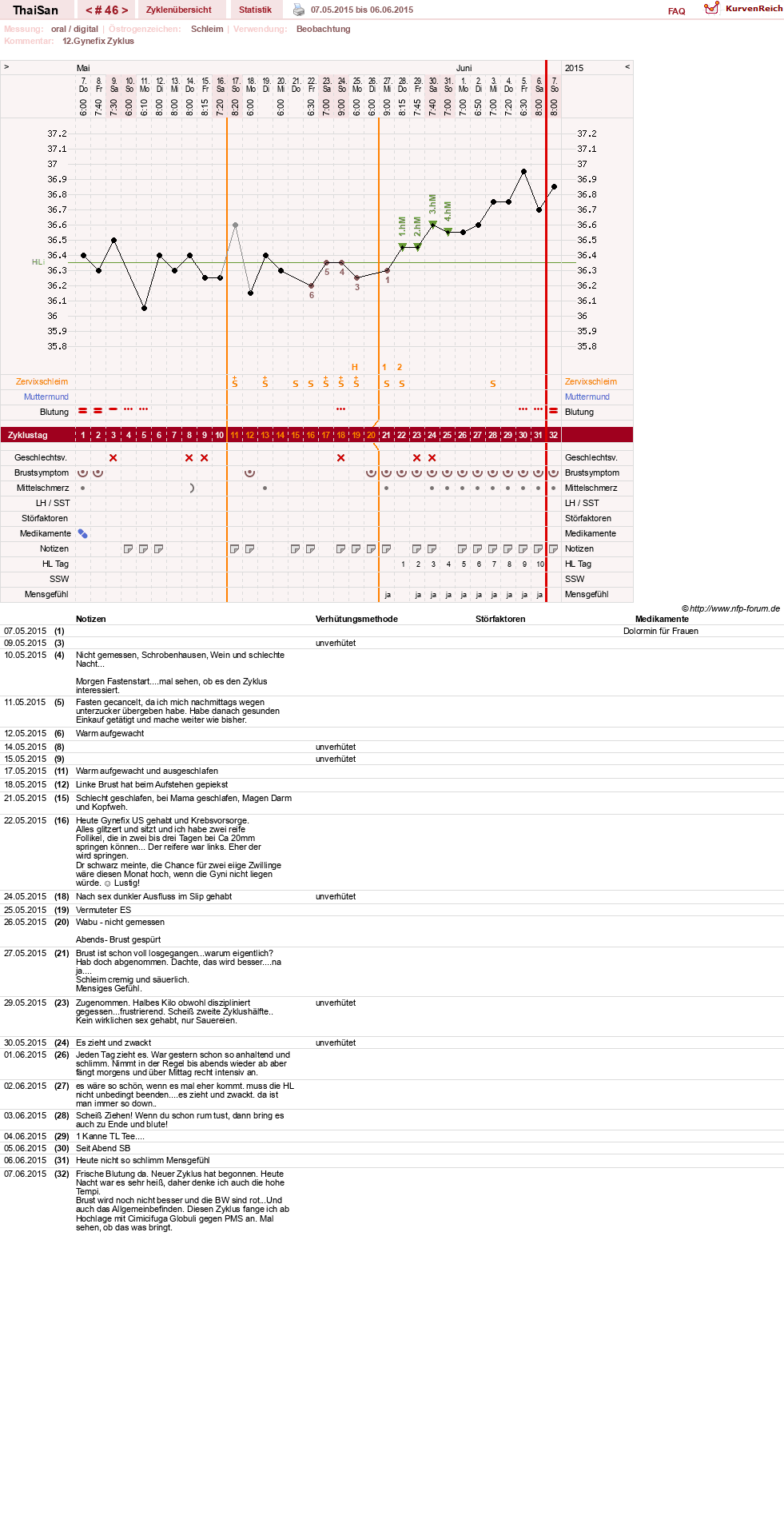 NFP-Kurve User #15832