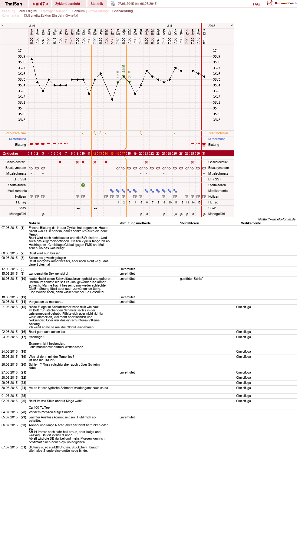 NFP-Kurve User #15832