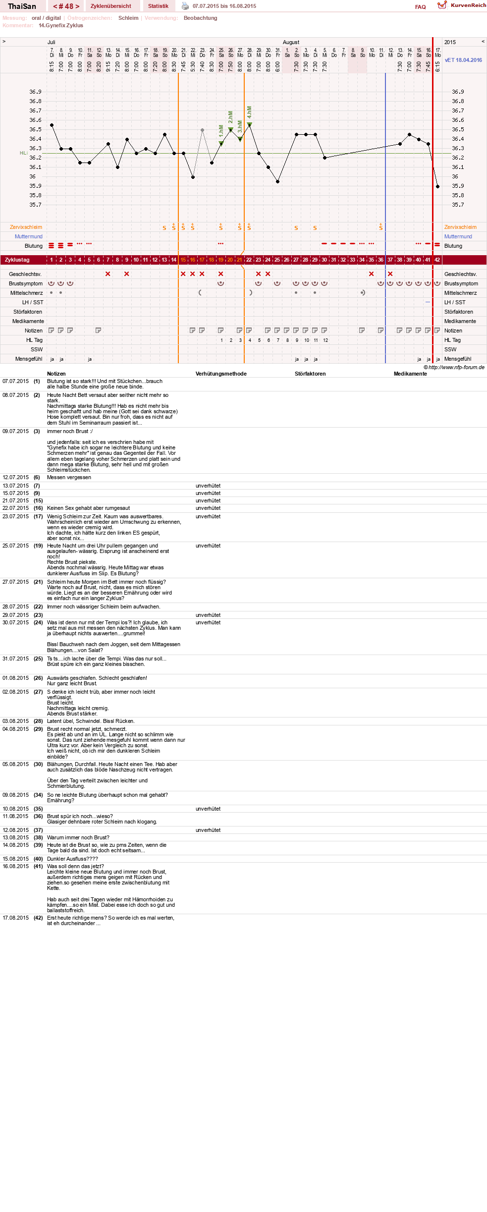 NFP-Kurve User #15832