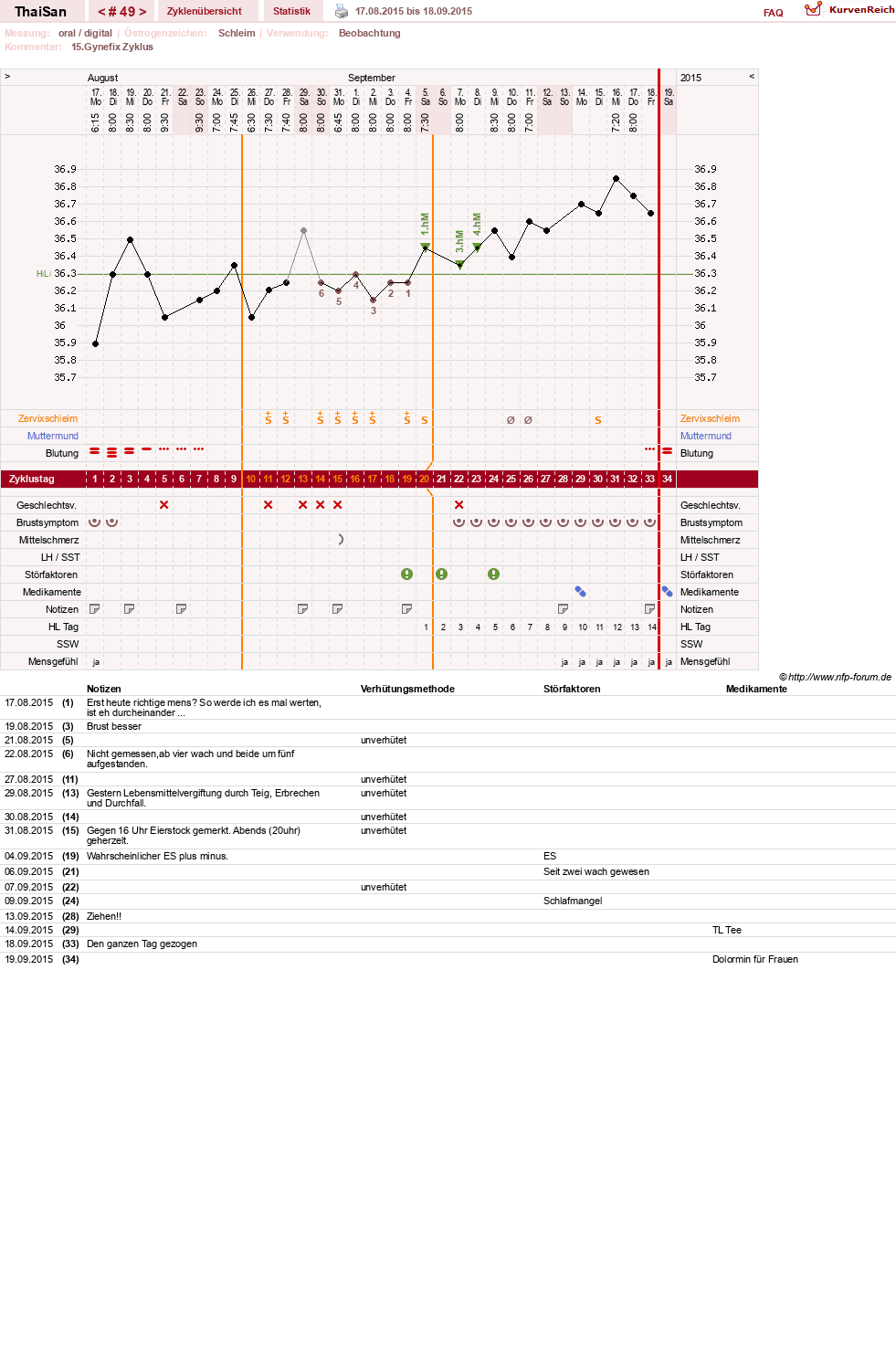 NFP-Kurve User #15832