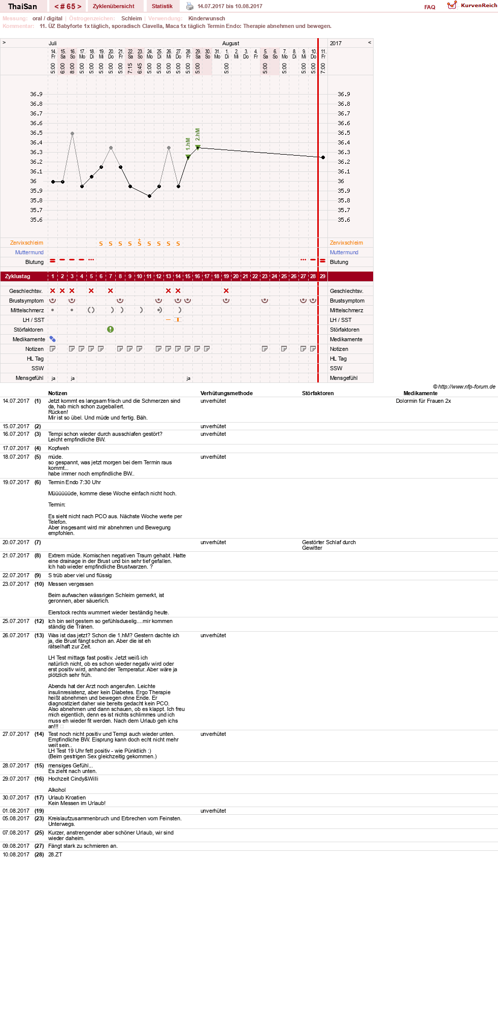 NFP-Kurve User #15832