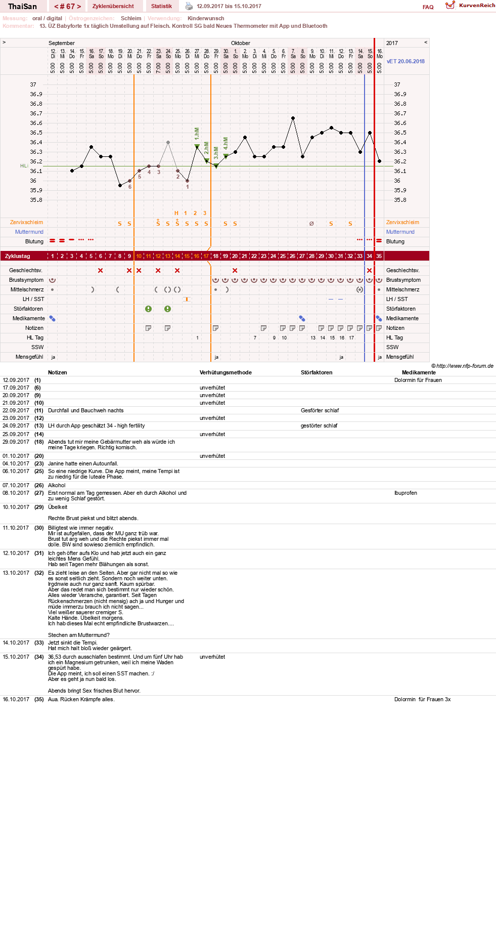 NFP-Kurve User #15832