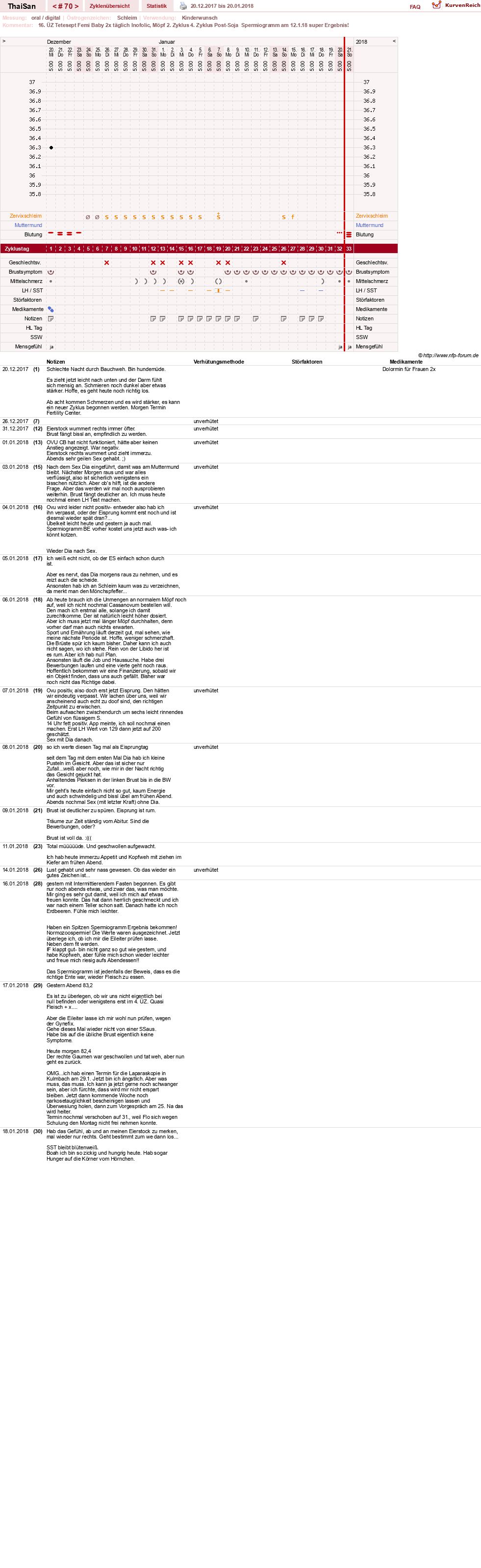 NFP-Kurve User #15832