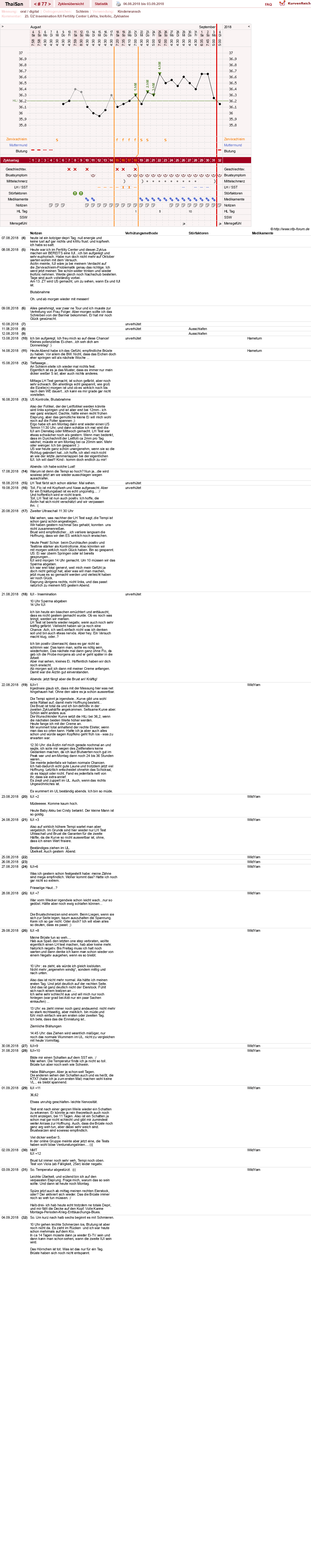 NFP-Kurve User #15832